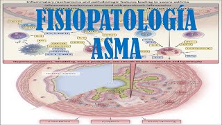 ASMA ETIOLOGÍA FISIOPATOLOGÍA Y DIAGNÓSTICO [upl. by Dahlstrom]