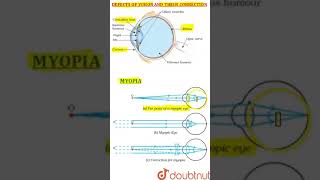 Defects of Vision and their Correction [upl. by Tatman]