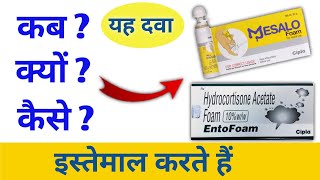 ulcerative colitis क्या होता है उससे बचने के लिए इनका कैसे करें इस्तेमाल।। mesalo foam how to use [upl. by Meta]