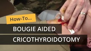 Bougie Aided Cricothyroidotomy [upl. by Dygal]