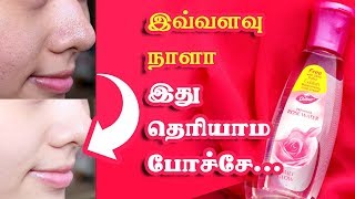 glycerine and rose water for skin whitening  glycerin for skin whitening su beauty and remedies [upl. by Nnahsal951]