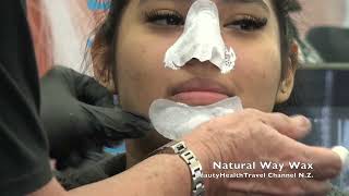 Blackhead Removal from Nose and Chin [upl. by Irahcaz]