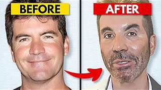 20 Celebrity Plastic Surgery Disasters [upl. by Enyedy]