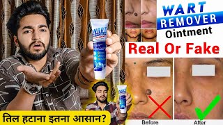 Wart Removal Cream Really Works  Wart Removal Cream Real Or Fake [upl. by Aman]