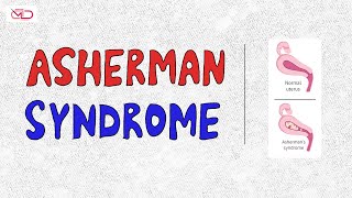 What is Asherman Syndrome  Clinical Presentation  Dr Shonali Chandra [upl. by Elmina]