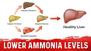 How to Lower Your Ammonia From Liver Cirrhosis  Ammonia Toxicity In Liver – Dr Berg [upl. by Nivag]