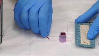 How to Measure the Hematocrit [upl. by Arielle928]