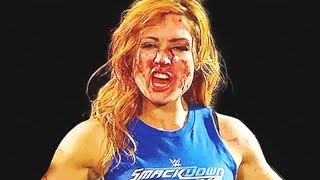 Why Becky Lynch Will Not Wrestle at WWE Survivor Series 2018 [upl. by Hannaoj967]