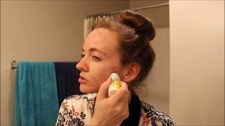 Will Clindamycin Help My Acne [upl. by Rhiamon533]