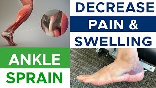 Ankle Sprain  Effectively Decrease Swelling And Pain [upl. by Emelen288]