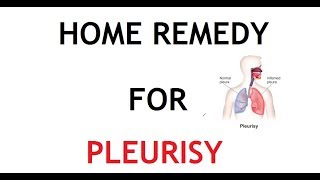 5 Home Remedy for Pleurisy [upl. by Xanthe]