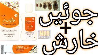 The SHOCKING Truth About Lotrix Lotion Urdu [upl. by Aihn]