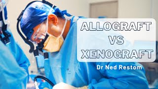 Interview with Dr Ned Restom  Allograft vs Xenograft [upl. by Neelloc]