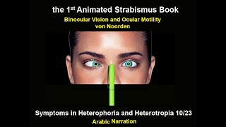 Symptoms in Heterophoria and Heterotropia and the Psychological Effects of Strabismus [upl. by Akemihs]