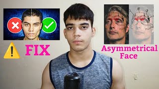 How to fix Asymmetrical  Uneven Face Naturally  How I Fixed my face Asymmetry in Just 60 Days [upl. by Yremrej372]