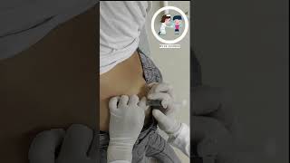 how to give im injection doctor injection [upl. by Enyaz892]