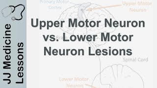 Upper and Lower Motor Neuron Lesions  UMN vs LMN Differences and Mnemonic [upl. by Adnic]