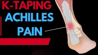 How to treat Achilles Tendonitis using Kinesiology tape [upl. by Atteinotna]