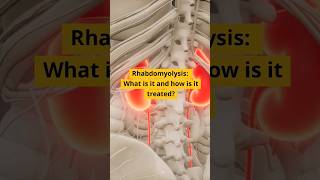 MRCP Shorts Rhabdomyolysis [upl. by Aratal203]