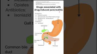 Drugs associated with druginduced pancreatitis [upl. by Junie]