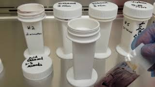 Microbiology Trichrome Staining Procedure [upl. by Pohsib]