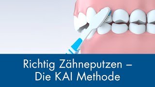 Richtig Zähneputzen  Die KAI Methode [upl. by Jecho]