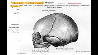 Pterion norma lateralis anatomy skull headandneckanatomy [upl. by Elene]