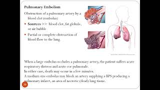 THORAX CLINICALS PPT  Part I  Dr M Kamran Ameer [upl. by Merth606]