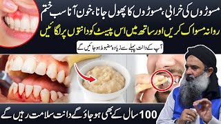 Danton Se Khoon Aana  Gum Bleeding Treatment At Home  Masoro Se Khoon Aane Ka Ilaj Dr Sharafat Ali [upl. by Seyler]