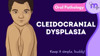 Cleidocranial Dysplasia  Features  Oral Manifestation  Treatment  Oral Pathology  Animated [upl. by Crescint]