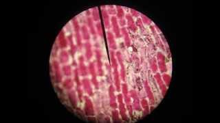 Osmosis and Plasmolysis  Red Onion Skin Cells [upl. by Rillis323]