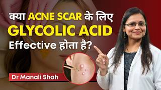 क्या Acne Scar के लिए Glycolic Acid Effective होता है Myths amp Facts About Glycolic Acid ClearSkin [upl. by Ruyam233]