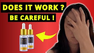 SKIN BIOTIX MD SKIN TAG REMOVER REVIEWS ❌NEW ALERT❌ Skin Biotix Skin Tag Remover Review [upl. by Iharas]