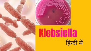 Klebsiella morphology pathogenesis lab diagnosis amp treatment in hindi [upl. by Ariajaj771]