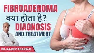 Fibroadenoma क्या होता है  Diagnosis and treatment for Fibroadenoma  Dr Rajeev Agarwal [upl. by Hannej763]