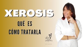 Piel Seca o Xerosis 🤔 Qué es la Xerosis y Cómo Tratarla [upl. by Raney713]