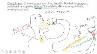 Renal vasculitis [upl. by Sculley764]