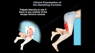 Clinical Evaluation of the Hamstring Muscles  Everything You Need To Know  Dr Nabil Ebraheim [upl. by Nedra]