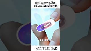 ഗുളികകളിൽ ഉള്ള അപകടംknowledge🪱😱shorts m4tech mrzthoppi [upl. by Norraf]