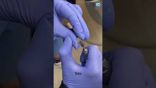 Temporary crown tips with Dr Tami shorts [upl. by Publia]