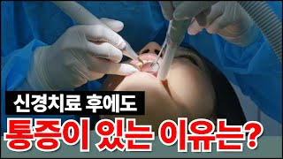 신경치료 후 통증 왜 남아있는 걸까요 🦷👨🏻‍⚕ [upl. by Pauly]