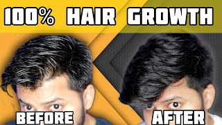 Best Hair Growth Technique  இத follow பண்ணா கண்டிப்பா முடி வளரும்  Tamil  Shadhik Azeez [upl. by Atiseret]