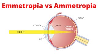 Emmetropia vs Ammetropia [upl. by Adnirod264]