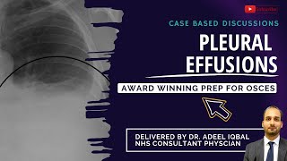 Pleural Effusion Cases  Respiratory  BEST OSCE Preparation for Medical Student Exams [upl. by Jed]