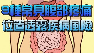 9種常見腹部疼痛，位置透露疾病風險！ [upl. by Anoirb439]