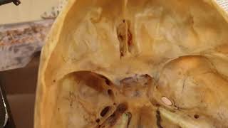 PARANASAL SINUSES FRONTAL AIR SINUS [upl. by Anidem]