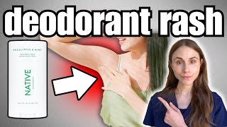 Say Goodbye To Deodorant Rash Learn The Causes And Treatments Here [upl. by Hsetih431]