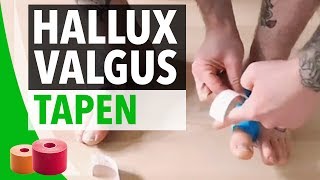 Hallux Valgus Tapen Anleitung  Zeh tapen Anleitung  Bodytape  Taping [upl. by Anselma]