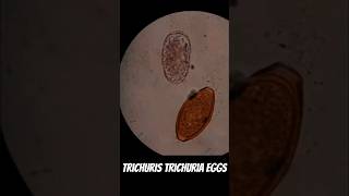 Trichuris trichuria eggs Parasitology [upl. by Wiencke]