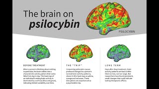 Psilocybin desynchronizes the human brain [upl. by Yannodrahc]